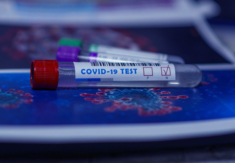 Protocolo de colaboração para testagem em lares e instituições aprovado em reunião de câmara